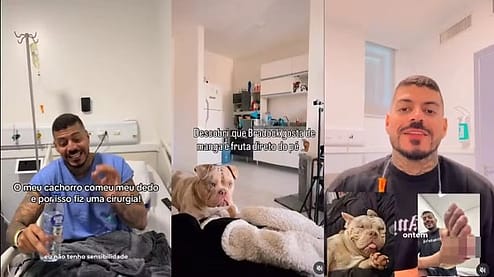 Influencidor de SC relata que cão comeu seu dedo